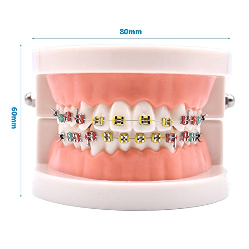 Angzhili Diş Ortodonti Gösteri Modeli Tedavi Modeli ile Metal Braket, Kemer Tel Açıklayan Modeli ile Parantez
