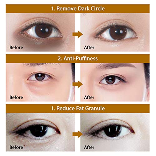 24 K Altın Göz Maskesi Anti-Aging Hyaluronik Asit Altında Göz Maskesi Azaltmak için Koyu Halkalar ve Kabarık Gözler, Hidrojel