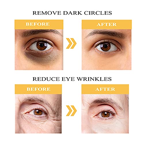 Göz Maskesi Altında 24K Altın, Şişlik ve Koyu Halkalar için Devimic 60Pcs Göz Altı Yamaları, Göz Torbası ve Kırışıklık Tedavisi
